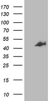 HEK293T cells were transfected with the pCMV6-ENTRY control (Left lane) or pCMV6-ENTRY CCM2 (Right lane) cDNA for 48 hrs and lysed. Equivalent amounts of cell lysates (5 ug per lane) were separated by SDS-PAGE and immunoblotted with anti-CCM2.