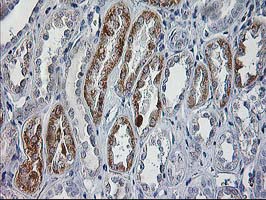 IHC of paraffin-embedded Human Kidney tissue using anti-CCM2 mouse monoclonal antibody.