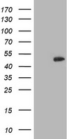 HEK293T cells were transfected with the pCMV6-ENTRY control (Left lane) or pCMV6-ENTRY CCM2 (Right lane) cDNA for 48 hrs and lysed. Equivalent amounts of cell lysates (5 ug per lane) were separated by SDS-PAGE and immunoblotted with anti-CCM2.