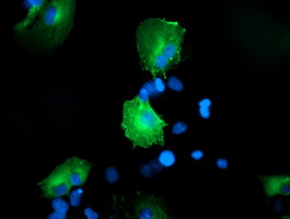 Anti-CCM2 mouse monoclonal antibody immunofluorescent staining of COS7 cells transiently transfected by pCMV6-ENTRY CCM2.