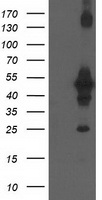 HEK293T cells were transfected with the pCMV6-ENTRY control (Left lane) or pCMV6-ENTRY CCM2 (Right lane) cDNA for 48 hrs and lysed. Equivalent amounts of cell lysates (5 ug per lane) were separated by SDS-PAGE and immunoblotted with anti-CCM2.
