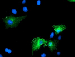 Anti-CCM2 mouse monoclonal antibody immunofluorescent staining of COS7 cells transiently transfected by pCMV6-ENTRY CCM2.