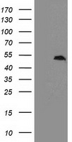 HEK293T cells were transfected with the pCMV6-ENTRY control (Left lane) or pCMV6-ENTRY CCM2 (Right lane) cDNA for 48 hrs and lysed. Equivalent amounts of cell lysates (5 ug per lane) were separated by SDS-PAGE and immunoblotted with anti-CCM2.