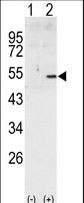 Western blot of CCNA2 (arrow) using rabbit polyclonal CCNA2 Antibody. 293 cell lysates (2 ug/lane) either nontransfected (Lane 1) or transiently transfected with the CCNA2 gene (Lane 2) (Origene Technologies).