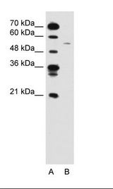 A: Marker, B: Jurkat Cell Lysate