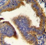 CCNB1 Antibody immunohistochemistry of formalin-fixed and paraffin-embedded human uterus tissue followed by peroxidase-conjugated secondary antibody and DAB staining.