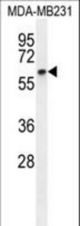 CCNB1 Antibody western blot of MDA-MB231 cell line lysates (35 ug/lane). The CCNB1 antibody detected the CCNB1 protein (arrow).