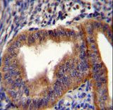 CCNB1 Antibody immunohistochemistry of formalin-fixed and paraffin-embedded human uterus tissue followed by peroxidase-conjugated secondary antibody and DAB staining.
