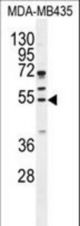 CCNB1 Antibody western blot of MDA-MB435 cell line lysates (35 ug/lane). The CCNB1 antibody detected the CCNB1 protein (arrow).