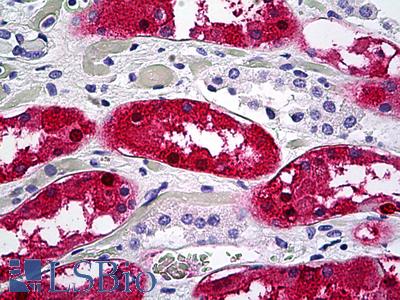 Anti-ACY1 / Aminoacylase-1 antibody IHC of human kidney, tubules. Immunohistochemistry of formalin-fixed, paraffin-embedded tissue after heat-induced antigen retrieval. Antibody LS-B5375 concentration 5 ug/ml.