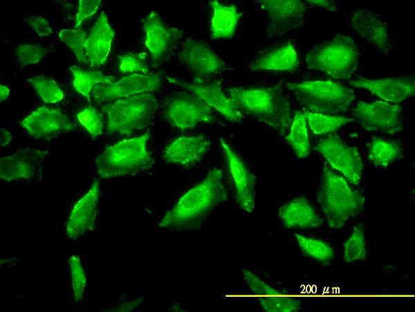 Immunofluorescence of monoclonal antibody to ACY1 on HeLa cell. [antibody concentration 10 ug/ml]
