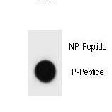 Dot blot of CCNB3 Antibody (Phospho T280) Phospho-specific antibody on nitrocellulose membrane. 50ng of Phospho-peptide or Non Phospho-peptide per dot were adsorbed. Antibody working concentrations are 0.6ug per ml.
