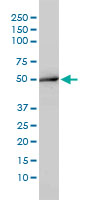 Western blot of ACY1 expression in K-562 by ACY1 monoclonal antibody (M01), clone 4F1-B7.