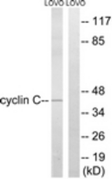 Western blot of extracts from LOVO cells, using Cyclin C Antibody. The lane on the right was incubated with synthetic peptide.