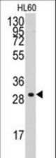 Western blot of anti-CCNC Antibody in HL60 cell line lysates (35 ug/lane). CCNC(arrow) was detected using the purified antibody.