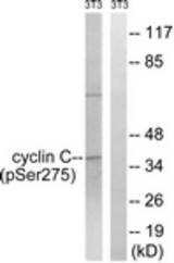 Western blot of extracts from NIH-3T3 cells treated with UV 15', using Cyclin C (Phospho-Ser275) Antibody. The lane on the right was incubated with synthetic peptide.