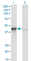 Western blot of ACY1 expression in transfected 293T cell line by ACY1 monoclonal antibody (M01), clone 4F1-B7.