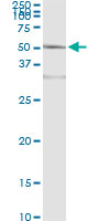 Immunoprecipitation of ACY1 transfected lysate using anti-ACY1 monoclonal antibody and Protein A Magnetic Bead.