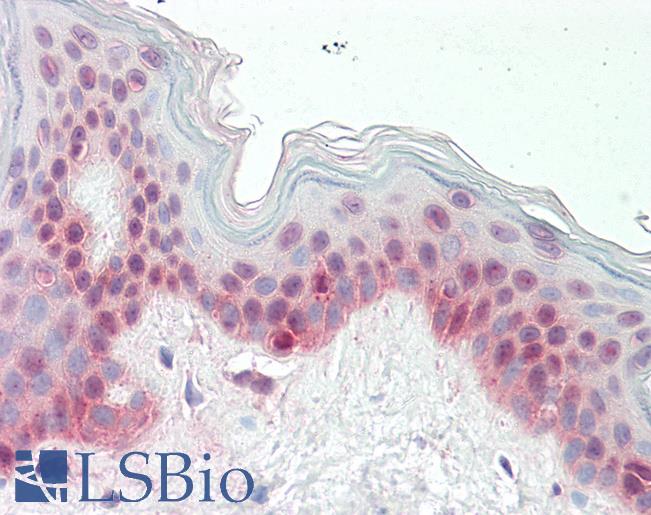 Human Skin: Formalin-Fixed, Paraffin-Embedded (FFPE)