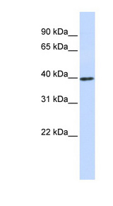 CCND1 / Cyclin D1 antibody western blot of 721_B cell lysate.