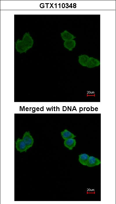 Immunofluorescence of paraformaldehyde-fixed A431, using Aminoacylase-1 antibody at 1:200 dilution.