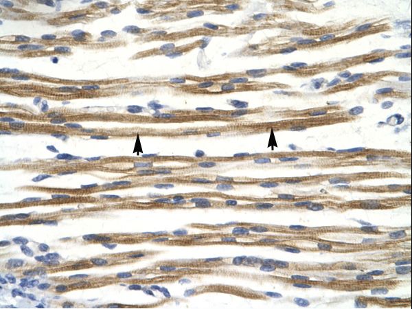 CCND3 / Cyclin D3 antibody LS-C29963 was used in IHC to stain formalin-fixed, paraffin-embedded human muscle.