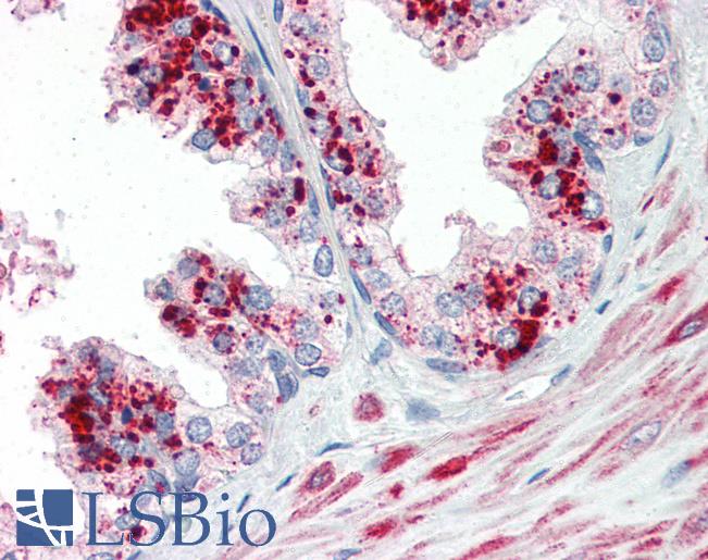 Anti-CCNDBP1 / GCIP antibody IHC of human prostate. Immunohistochemistry of formalin-fixed, paraffin-embedded tissue after heat-induced antigen retrieval. Antibody LS-B3070 concentration 5 ug/ml.