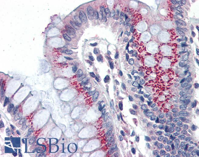 Anti-CCNDBP1 / GCIP antibody IHC of human colon. Immunohistochemistry of formalin-fixed, paraffin-embedded tissue after heat-induced antigen retrieval. Antibody LS-B3070 concentration 5 ug/ml.