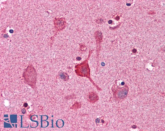 Anti-CCNDBP1 / GCIP antibody IHC of human brain, cortex. Immunohistochemistry of formalin-fixed, paraffin-embedded tissue after heat-induced antigen retrieval. Antibody LS-B4443 concentration 3.75 ug/ml.