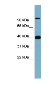 CCNDBP1 / GCIP antibody LS-C111649 Western blot of Fetal Small Intestine lysate.