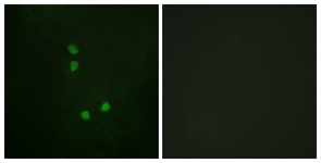 Immunofluorescence of NIH-3T3 cells, using Cyclin E2 (Phospho-Thr392) Antibody. The sample on the right was incubated with synthetic peptide.
