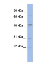 CCNE2 / Cyclin E2 antibody LS-C112298 Western blot of 3 Cell lysate. Antibody concentration 1 ug/ml.