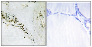 IHC of paraffin-embedded human thyroid gland tissue, using Cyclin E2 (Ab-392) Antibody. The picture on the right is treated with the synthesized peptide.