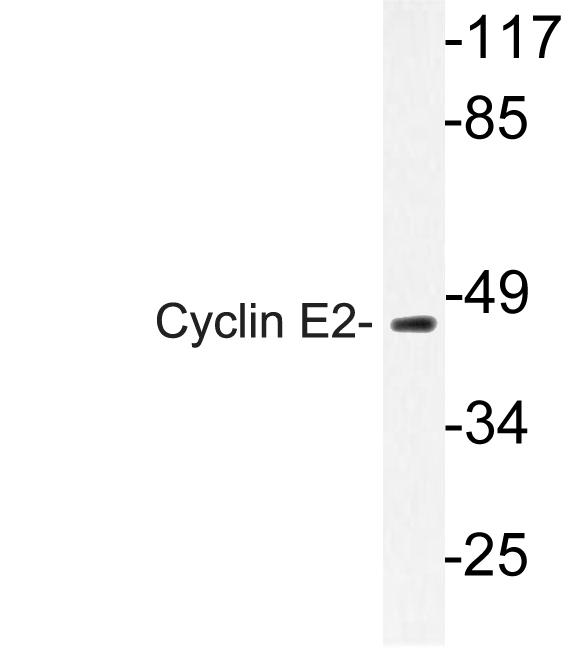 Western blot of Cyclin E2 (N387) pAb in extracts from Jurkat cell'.