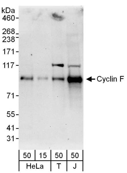 Detection of Human Cyclin F by Western Blot. Samples: Whole cell lysate from HeLa (15 and 50 ug), 293T (T; 50 ug) and Jurkat (J; 50 ug) cells. Antibody: Affinity purified rabbit anti-Cyclin F antibody used for WB at 0.1 ug/ml. Detection: Chemiluminescence with an exposure time of 30 seconds.