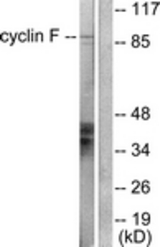 Western blot of extracts from HeLa cells, using Cyclin F Antibody. The lane on the right is treated with the synthesized peptide.