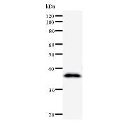Western blot analysis of immunized recombinant protein, using anti-CCNF monoclonal antibody.