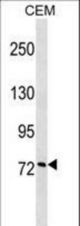 CCNF Antibody western blot of CEM cell line lysates (35 ug/lane). The CCNF Antibody detected the CCNF protein (arrow).