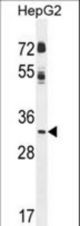 CCNG1 Antibody western blot of HepG2 cell line lysates (35 ug/lane). The CCNG1 antibody detected the CCNG1 protein (arrow).