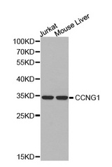 Western blot analysis of extracts of Jurkat cell and mouse liver cell line, using CCNG1 antibody.