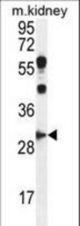 CCNG1 Antibody western blot of mouse kidney tissue lysates (35 ug/lane). The CCNG1 antibody detected the CCNG1 protein (arrow).