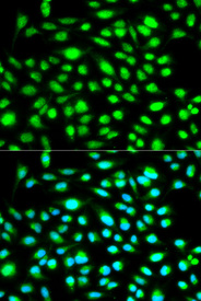 Immunofluorescence analysis of HeLa cell using CCNH antibody. Blue: DAPI for nuclear staining.