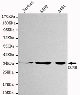 Western blot detection of CCNH in Jurkat,K562&A431 cell lysates using CCNH antibody (1:1000 diluted).