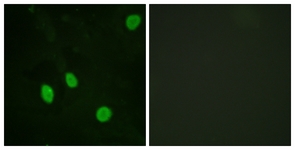 Immunofluorescence of HeLa cells, using Cyclin H (Ab-315) Antibody. The picture on the right is treated with the synthesized peptide.