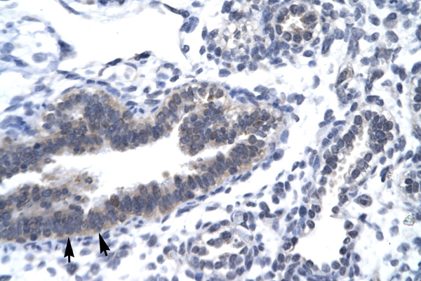 CCNH / Cyclin H antibody LS-C30772 IHC of formalin-fixed, paraffin-embedded human Lung. Positive label: Epithelial cells of bronchiole indicated with arrows. Antibody concentration 4-8 ug/ml. Magnification 400X.