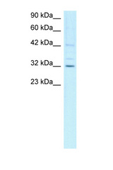 CCNH / Cyclin H antibody LS-C30772 Western blot of Jurkat Cell lysate. Antibody concentration 1 ug/ml.