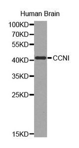 Western blot analysis of extracts of human brain cell line, using CCNI antibody.