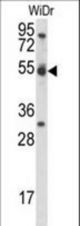 CCNI Antibody western blot of WiDr cell line lysates (35 ug/lane). The CCNI antibody detected the CCNI protein (arrow).