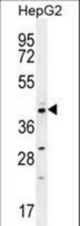 CCNI2 Antibody western blot of HepG2 cell line lysates (35 ug/lane). The CCNI2 antibody detected the CCNI2 protein (arrow).