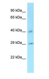 CCNJ antibody Western Blot of Rat Liver.